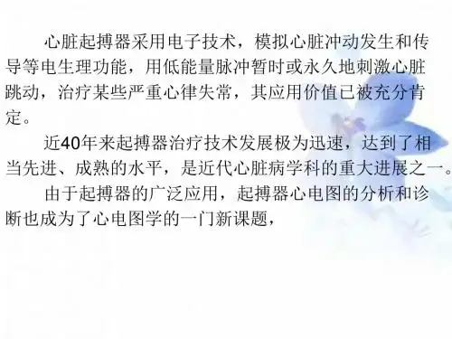 分析起搏器心电图