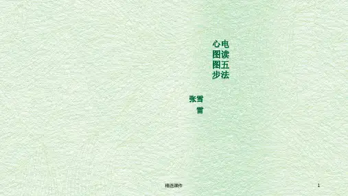 心电图读图五步法