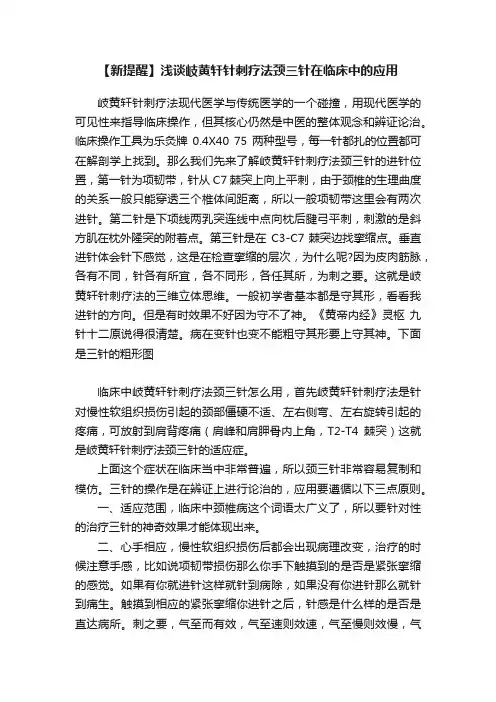 【新提醒】浅谈岐黄轩针刺疗法颈三针在临床中的应用