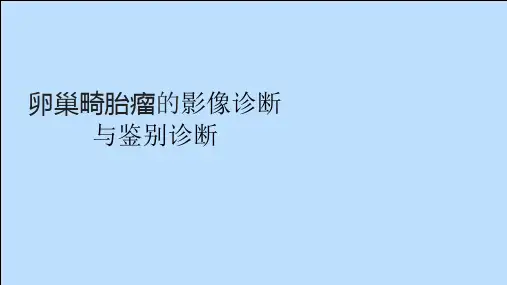 卵巢畸胎瘤的影像诊断与鉴别诊断