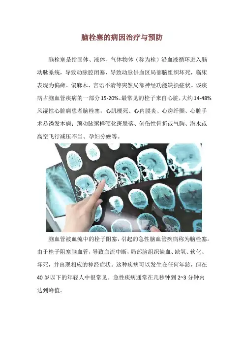 脑栓塞的病因治疗与预防