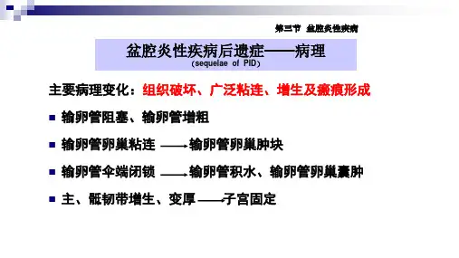 妇产科常见病 妇科常见疾病 盆腔炎性疾病后遗症(临床诊疗课件)