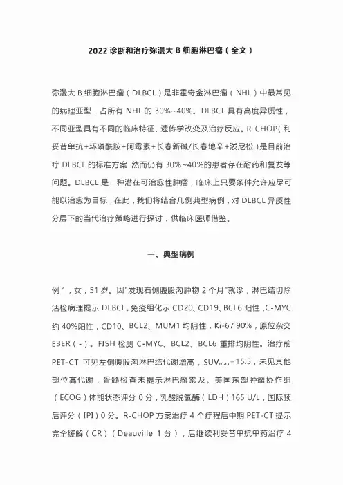 2022诊断和治疗弥漫大B细胞淋巴瘤(全文)