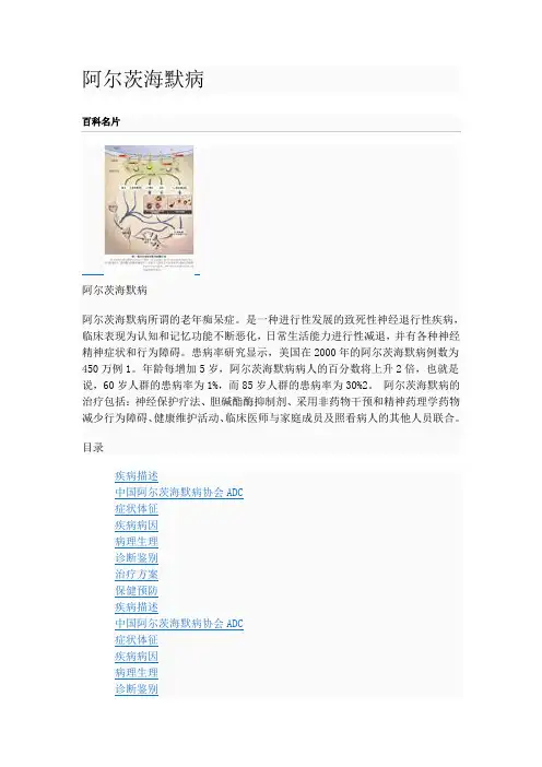 阿尔茨海默病