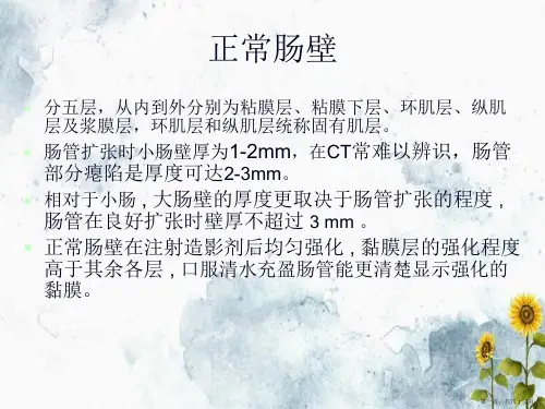 肠道增厚影像表现及鉴别诊断