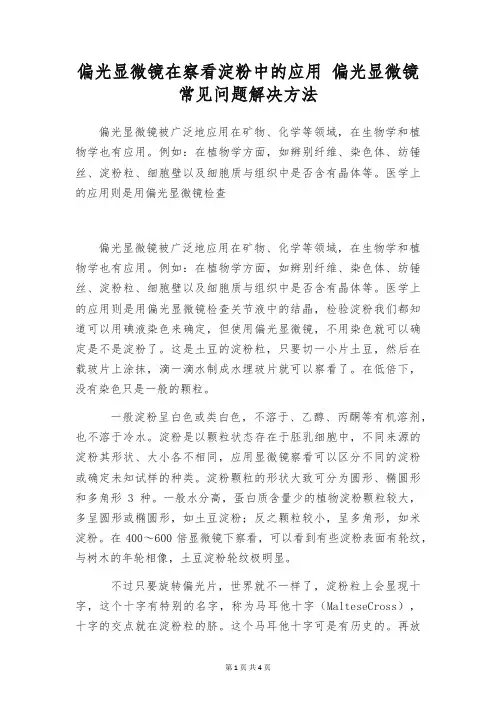 偏光显微镜在察看淀粉中的应用 偏光显微镜常见问题解决方法