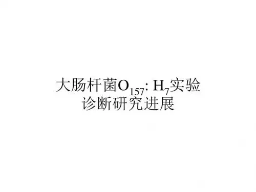 大肠杆菌O157 H7实验诊断研究进展