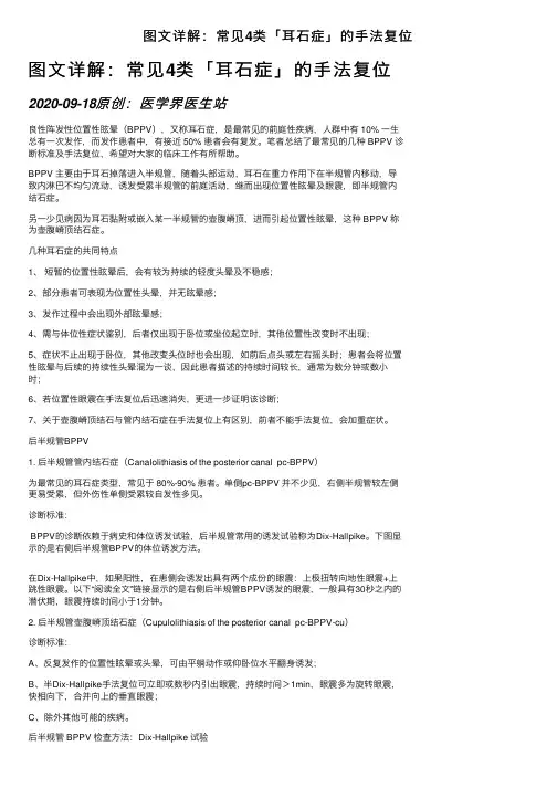 图文详解：常见4类「耳石症」的手法复位