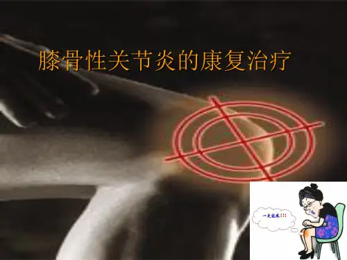 关节炎康复ppt课件