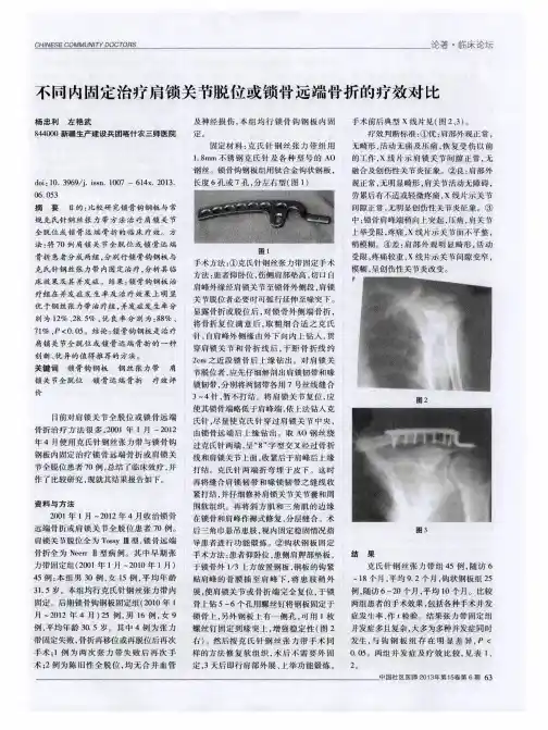 不同内固定治疗肩锁关节脱位或锁骨远端骨折的疗效对比