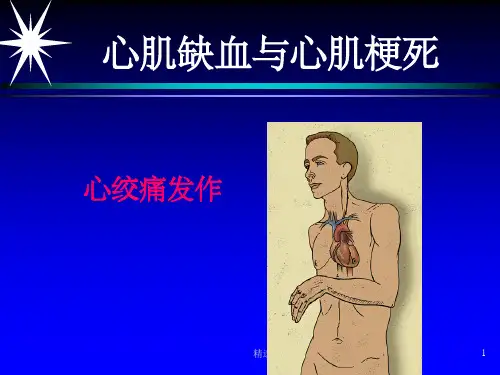 心肌缺血、心肌梗死