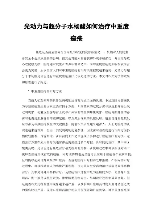 光动力与超分子水杨酸如何治疗中重度痤疮