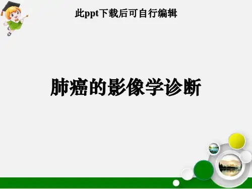 肺癌的影像学诊断ppt课件