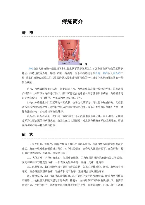 痔疮简介