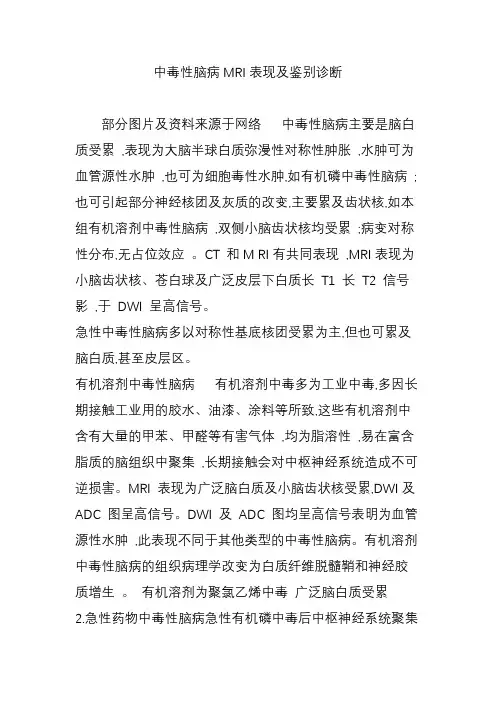 中毒性脑病MRI表现及鉴别诊断