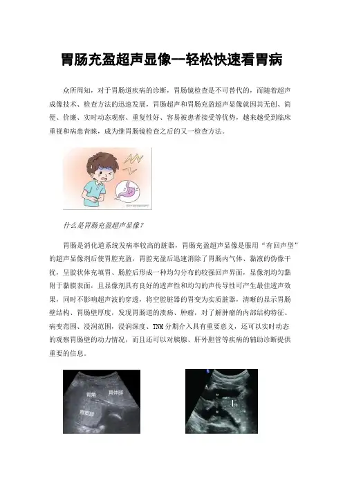 胃肠充盈超声显像--轻松快速看胃病