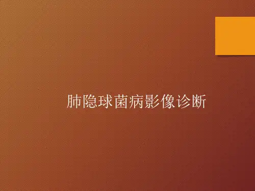 肺隐球菌病影像诊断