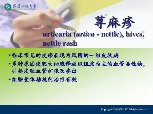 皮肤病学之荨麻疹