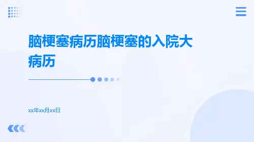 脑梗塞病历脑梗塞的入院大病历