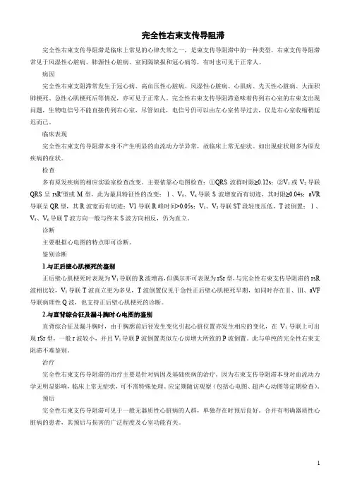 完全性右束支传导阻滞