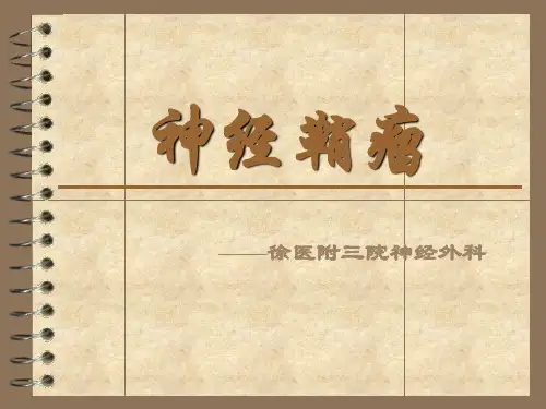 神经鞘瘤