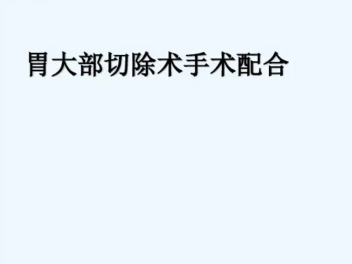 胃大部切除术手术配合 PPT