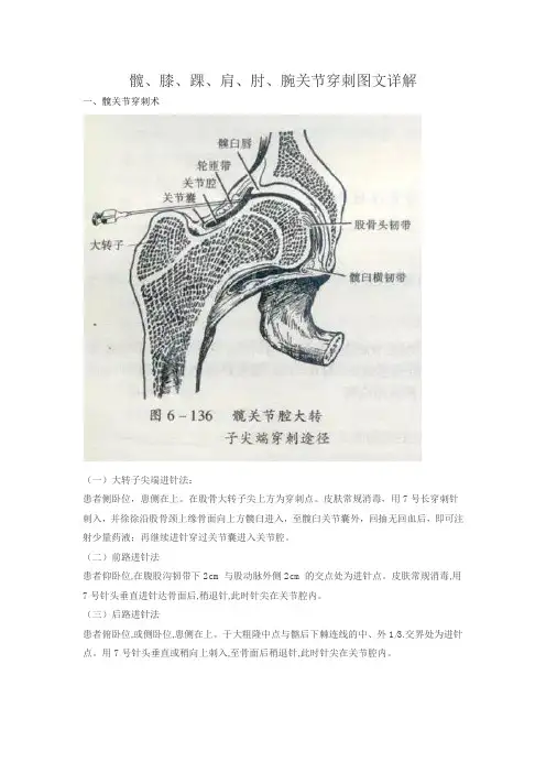 髋、膝、踝、肩、肘、腕关节穿刺图文详解