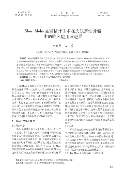 Slow Mohs显微描计手术在皮肤恶性肿瘤中的临床应用及进展
