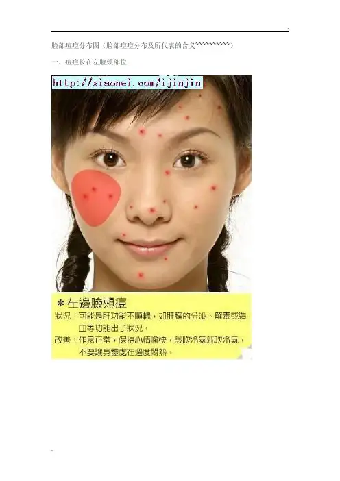 脸部痘痘分布图(彩图)及含义及解决房、方法