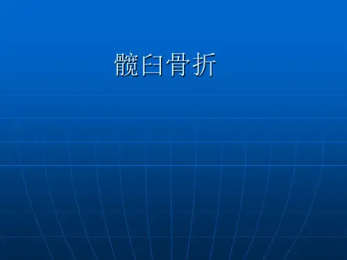 髋臼骨折资料讲解