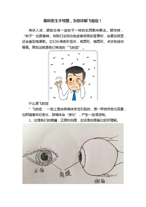 眼科医生手绘图，为您详解飞蚊症！