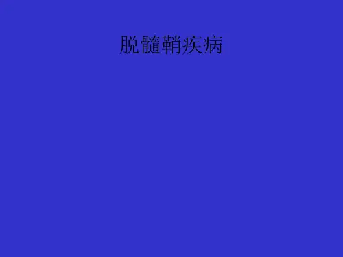脱髓鞘疾病
