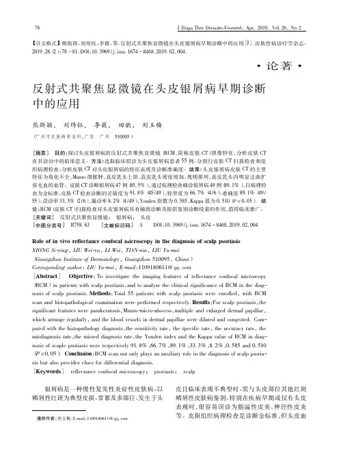 反射式共聚焦显微镜在头皮银屑病早期诊断中的应用