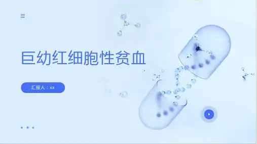 巨幼红细胞性贫血