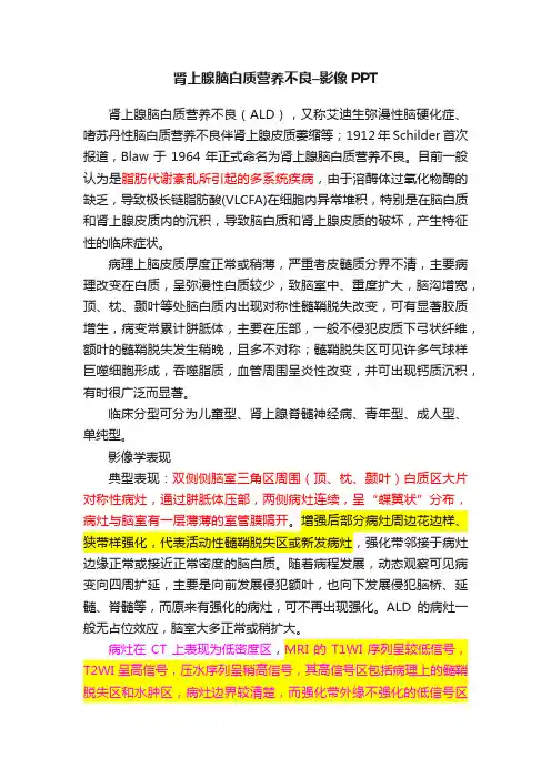 肾上腺脑白质营养不良–影像PPT