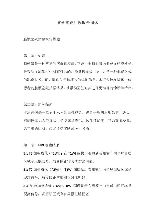 脑梗塞磁共振报告描述