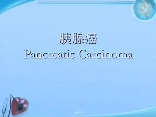 胰腺癌  ppt课件