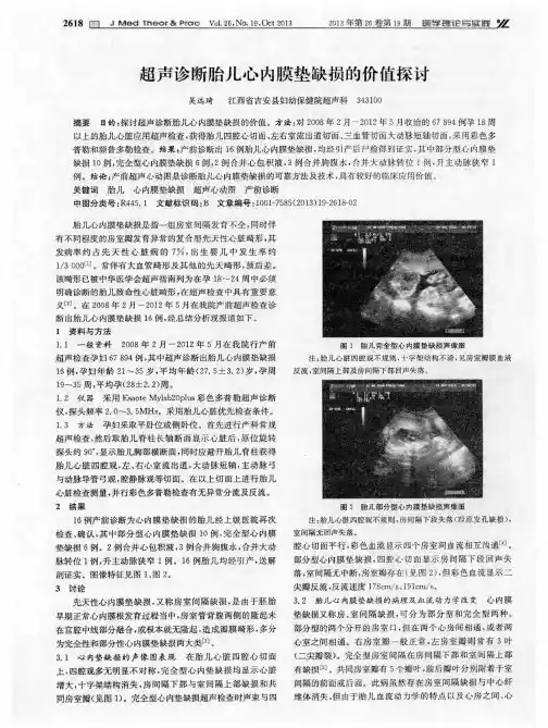 超声诊断胎儿心内膜垫缺损的价值探讨
