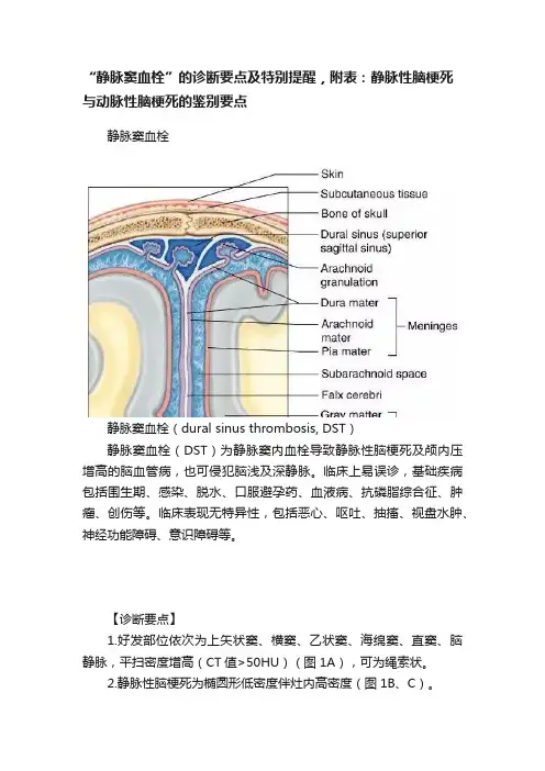 “静脉窦血栓”的诊断要点及特别提醒，附表：静脉性脑梗死与动脉性脑梗死的鉴别要点