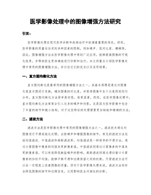 医学影像处理中的图像增强方法研究