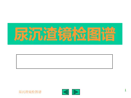 尿沉渣镜检图谱