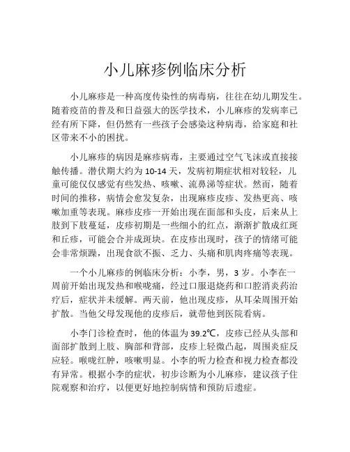 小儿麻疹例临床分析
