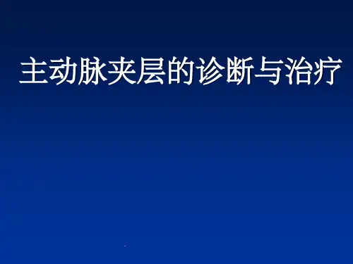 主动脉夹层(AD)临床诊断和治疗