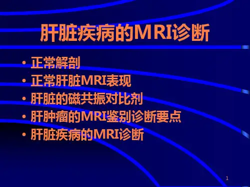 肝脏肿瘤MRI诊断ppt课件