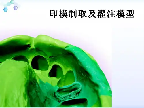 印模制取及灌注模型