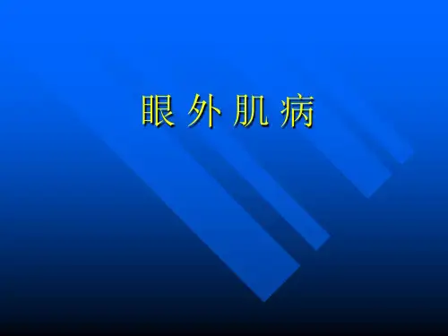 斜视及诊治.