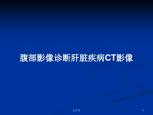 腹部影像诊断肝脏疾病CT影像PPT教案