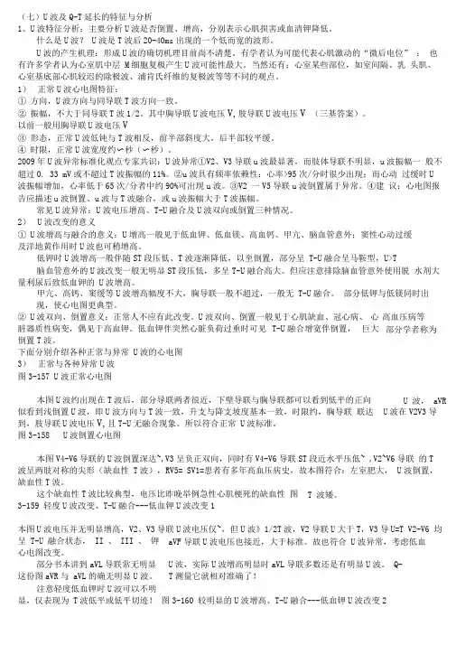 另类心电图学讲义11--U波与Q-T分析
