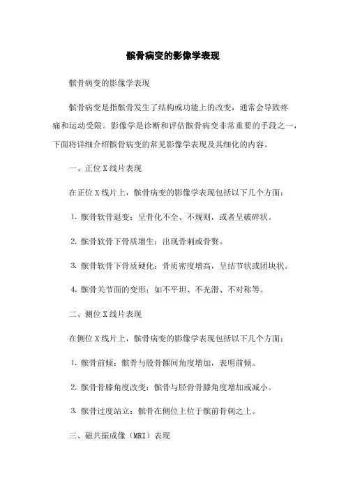 髌骨病变的影像学表现