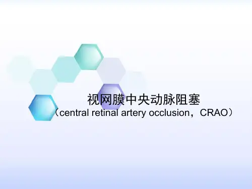 视网膜中央动脉阻塞